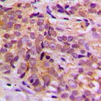 CEP170 Antibody (Internal)