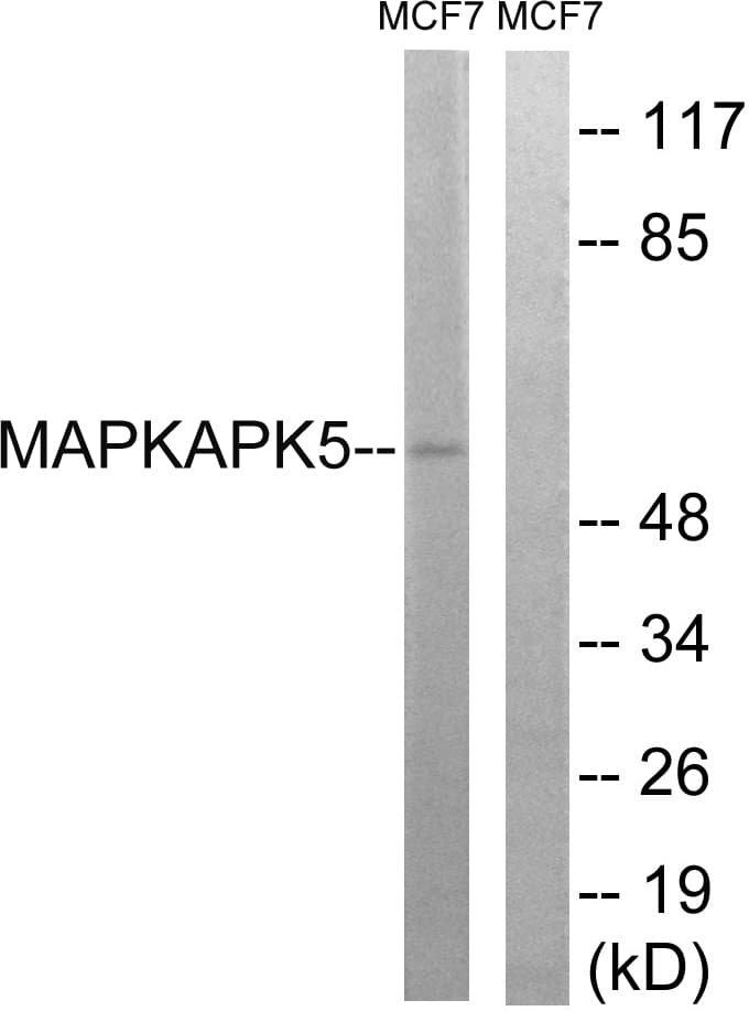 MAPKAPK5 / PRAK Antibody (aa148-197)