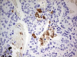 CD68 Antibody (aa22-319, clone OTI4G1)