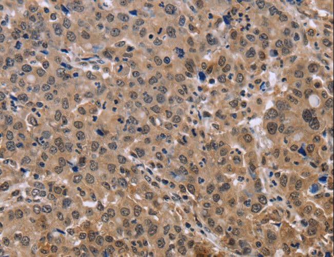 KIF25 Antibody