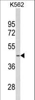 Polyclonal Rabbit anti-Human SDS Antibody (aa1-30, WB)