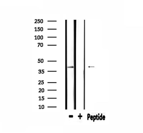 EPHX4 / Epoxide Hydrolase 4 Antibody