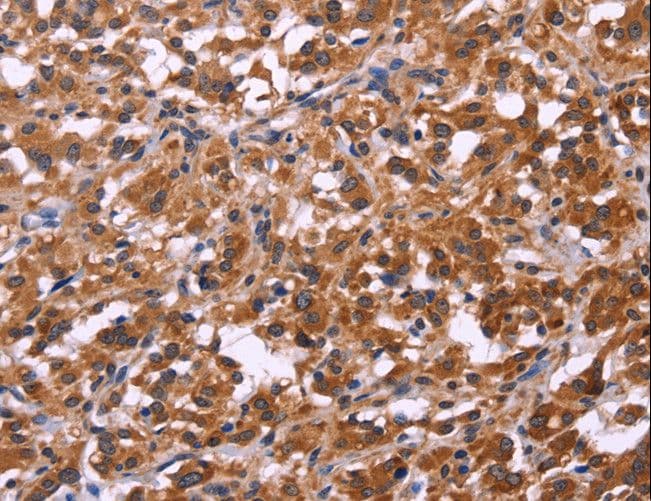 LCA3 / SPATA7 Antibody
