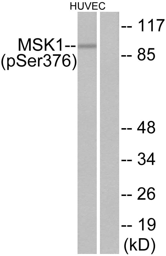 RPS6KA5 / MSK1 Antibody (phospho-Ser376)