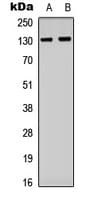 Polyclonal Rabbit anti-Human ITGB3 / Integrin Beta 3 / CD61 Antibody (phospho-Tyr773, IHC, WB)