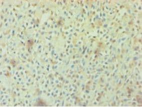 AGO2 / EIF2C2 Antibody (aa517-818)
