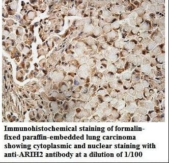 ARIH2 Antibody (aa9-203)