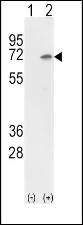XRCC6 / Ku70 Antibody (aa432-461)