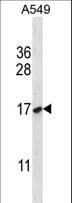 NFYB Antibody (aa17-46)