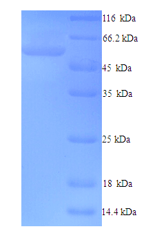 Human FBXO3 Protein (Recombinant His)
