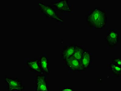 Polyclonal Rabbit anti-Human H2AFB1 Antibody