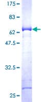Human DDX / AKR1C3 Protein (Recombinant GST)