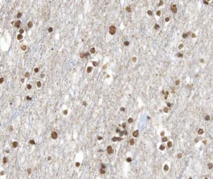 RARB / RAR Beta Antibody