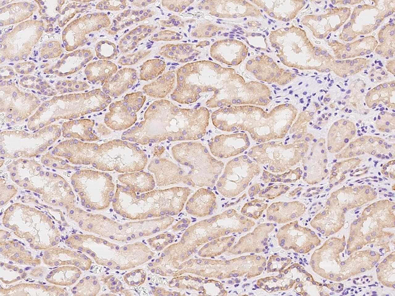 HINT3 Antibody