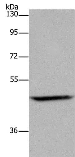 Polyclonal Rabbit anti-Human ETS2 Antibody (WB)