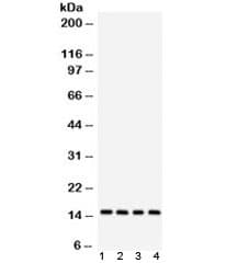 Polyclonal Rabbit anti-Human LGALS1 / Galectin 1 Antibody (IHC, WB)