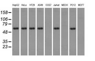 TS / Thromboxane Synthase Antibody (clone OTI2C1)