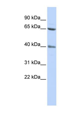 ZNF192 Antibody (aa144-193)