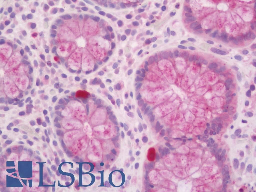 IHC-plus™ Polyclonal Goat anti-Mouse RAB27A / RAB27 Antibody (C-Terminus, IHC, IF, WB)