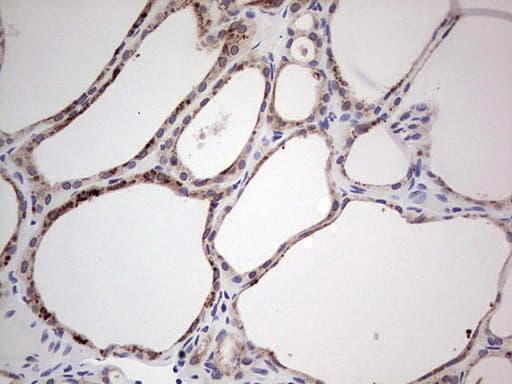 HDAC9 Antibody (aa181-460, clone OTI6E2)
