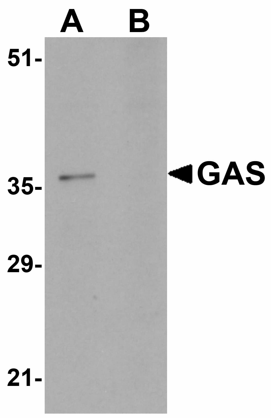 IHC-plus™ PAGR1 / C16orf53 Antibody