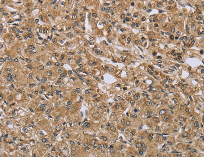 TXLNA / Alpha Taxilin Antibody