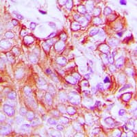 Polyclonal Rabbit anti-Human ERBB4 / HER4 Antibody (C-Terminus, IHC, IF, WB)