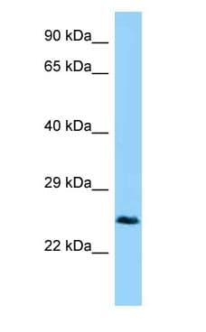 Polyclonal Rabbit anti-Mouse CTHRC1 Antibody (C-Terminus, WB)