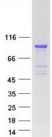 Human KBTBD6 Protein (Recombinant Myc-DDK (Flag))