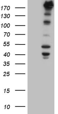 Monoclonal Mouse anti-Human NES / Nestin Antibody (clone OTI1B4, aa99-349, IHC, WB)