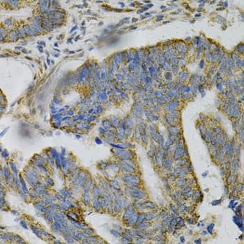 AK1 / Adenylate Kinase 1 Antibody