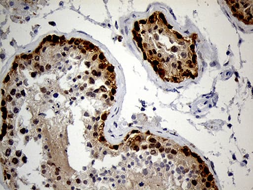 Monoclonal Mouse anti-Human IMP-3 / IGF2BP3 Antibody (clone OTI6A3, IHC, WB)