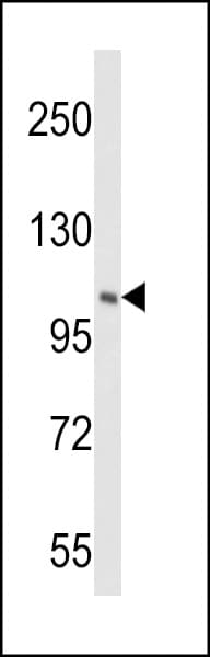 PIK4CB / PI4KB Antibody (aa519-548)