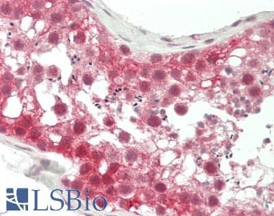 IHC-plus™ Polyclonal Rabbit anti-Human KLHL9 Antibody (aa299-326, IHC, WB)