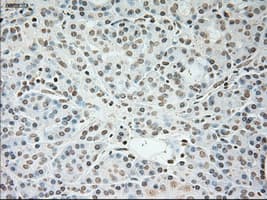 TNNI3 / Cardiac Troponin I Antibody (clone OTI4A3)