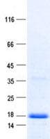 Human YPEL3 Protein (Recombinant His, N-Terminal)