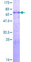 Human MYOD / MYOD1 Protein (Recombinant GST)