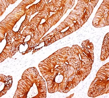 KRT8 / CK8 / Cytokeratin 8 Antibody (clone K8/383, Ready-to-Use)
