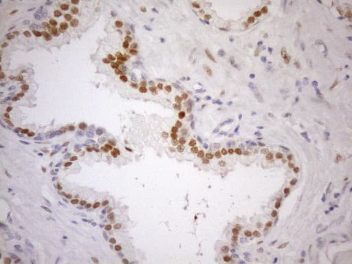 Monoclonal Mouse anti-Human AR / Androgen Receptor Antibody (clone OTI1D3, Carrier-free, aa420-659, IHC, WB)