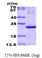 Human MRPL13 Protein (Recombinant His)