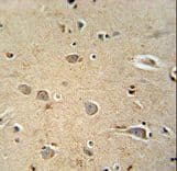 PQLC1 Antibody (aa100-128)