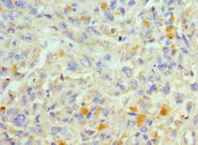 Polyclonal Rabbit anti-Human FADD Antibody (aa1-208, IHC)