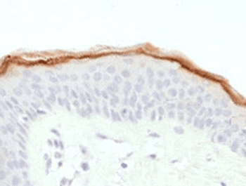 Monoclonal Mouse anti-Human FLG / Filaggrin Antibody (clone FLG1-1, IHC)