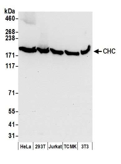 CLTC / Clathrin Heavy Chain Antibody (aa1625-1675)