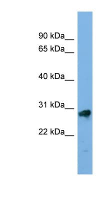 Polyclonal Rabbit anti-Human KLK13 / Kallikrein 13 Antibody (aa71-120, WB)