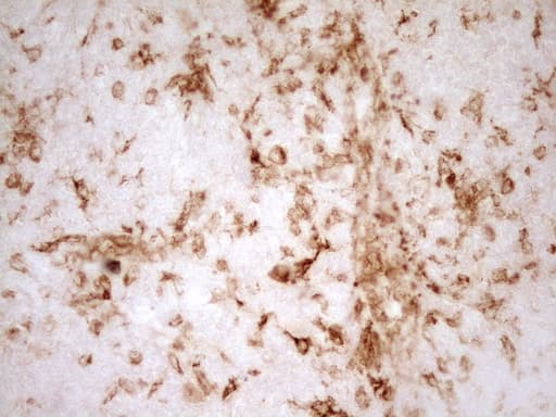 GRN / Granulin Antibody (aa327-593, clone OTI1F9)