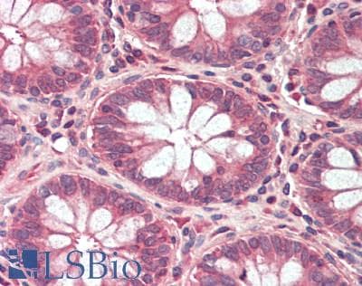 IHC-plus™ Polyclonal Rabbit anti-Human GPD2 Antibody (IHC, WB)