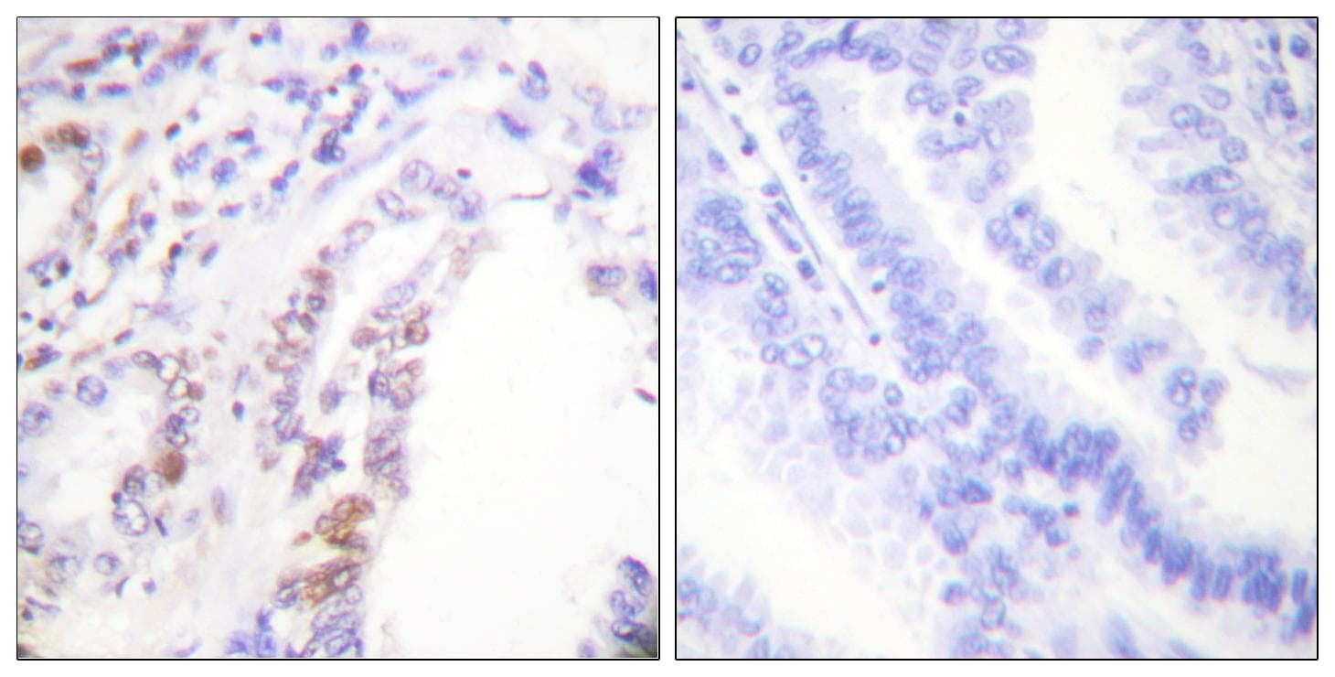 AML1 / RUNX1 Antibody (p303)
