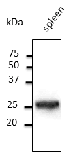 PathPlus™ RAB5A / RAB5 Antibody (C-Terminus)