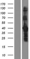DMRTB1 Protein (Over-Expression Lysate Myc-DDK (Flag))